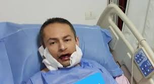 إخلاء سبيل صاحب "كلبي التجمع" بكفالة مالية.. وحبس خفير الفيلا لهذا السبب
